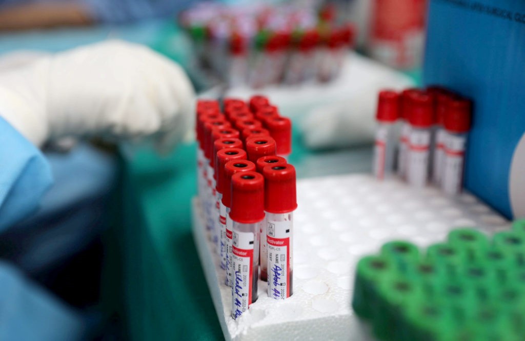 SANTA SÉ QUER DISTRIBUIÇÃO UNIVERSAL DA VACINA ANTI-COVID 19